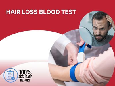Hair Loss Blood Test